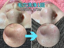 パルテールの雰囲気（1回でここまで!? 詰まり・黒ずみ徹底リセット！専門店の毛穴洗浄）