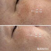 アネラ キキ サロン(anela kiki salon)