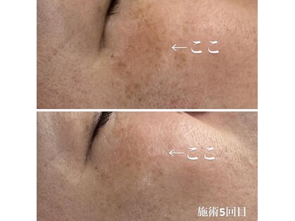 アネラ キキ サロン(anela kiki salon)の写真