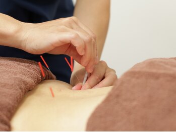 ふなこし鍼灸接骨院の写真/<美容鍼>親切丁寧な施術×全スタッフ国家資格保持!!鍼が怖かった方・初めてで不安な方も◎初回半額