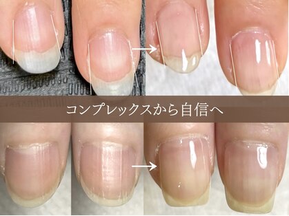 アーク(arc)の写真