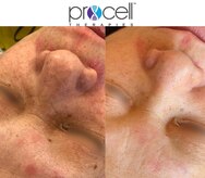 ヒルナム(Heal Nam)