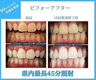 ホワイトニングショップ 各務原店