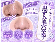ルイスラグジュアリー(LOUIS LUXURY)の雰囲気（《黒ずみ毛穴遂に卒業1回目から効果◎》顔全体の毛穴吸引￥15980）