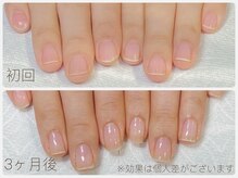 アウラ ネイル ファクトリー(aura nail factory)の雰囲気（最強のネイルケアで地爪育成☆深爪矯正☆綺麗な縦長美爪に♪♪）