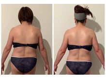 ドープ(Dope)/背中骨気