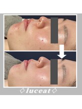 ルーチェット(luceat)/