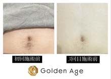 ゴールデンエイジ(Golden Age)