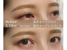 バルコニー(valcony)