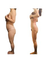 エモーション 横浜関内店(Emotion)/お腹/痩せ横浜痩身エステサロン