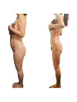 エモーション 横浜関内店(Emotion)/お腹/痩せ横浜痩身エステサロン