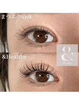 イノワ アイラッシュ(Innowo)/アンドヘルシー