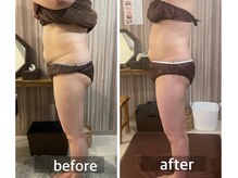 リムアール(Limh R)/