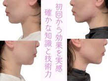 クアダ 天神(QUADA)