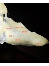 クラティス(CRATIS)/【松ヤニパック】艶々たまご肌へ