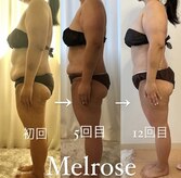 メルローズ 自由が丘店(Melrose)