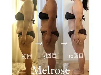 メルローズ 自由が丘店(Melrose)