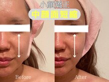 エステティックサロン フェアリー(ESTHETIC SALON FAIRLY)/小顔矯正×美骨顔筋マッサージ★