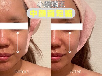 エステティックサロン フェアリー(ESTHETIC SALON FAIRLY)/小顔矯正×美骨顔筋マッサージ★