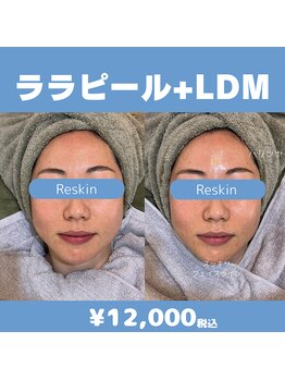 リスキン(Reskin)/《ツヤ、リフトアップ》