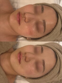 セレニテ(Serenite)/