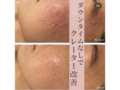 ラヴィ(La vie)の写真