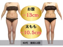 40代　施術12回　ビフォーアフター