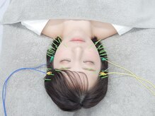 小顔美容鍼灸院HARIKA横浜店【美容鍼×小顔矯正×ブライダル】【4/1NEWOPEN（予定）】/中顔面短縮にオススメの美容鍼