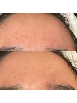 ウェリナベル(WelinaBelle)/ダクトピール肌を内側から再生