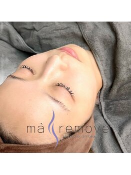 ニーナアイプラス(nina eye+)の写真/【お肌をきれいに】マリムーブフェイシャルワックスとLDMで理想の肌へ♪