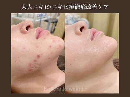 エピア 三河安城店(Epia)の写真