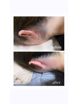 サロンドベル(salon de Belle)/うなじ