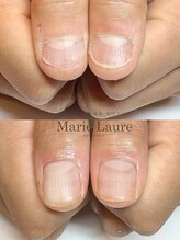 マリーロール 淀屋橋本店(Marie Laure)/深爪矯正/自爪風/自爪育成