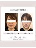 【当日ご予約限定】ご予定前に即効果！mielu式小顔　輪郭/リフトup  90分