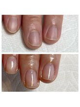 エマネイル(emma nail)/スラっと縦長の美爪に！