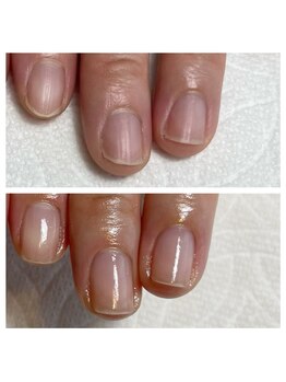 エマネイル(emma nail)/スラっと縦長の美爪に！
