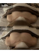 ハートランド(HEARTLAND)/バストのボリュームがほしい