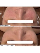 ミエル 恵比寿店(Miel)/リアボーテトリートメント