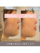 ルフレ(Reflet)/舌の位置が美と健康へのカギ