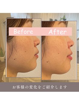 ルフレ(Reflet)/舌の位置が美と健康へのカギ