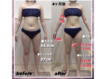 エステティック レイビス 八戸店(RAYVIS)/４ヶ月で-5キロ成功！