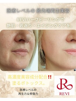 ベッラ(BELLA)の写真/いつまでも若々しいお肌へ♪