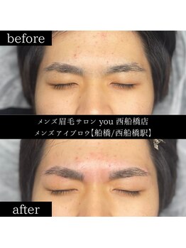 ユー 西船橋店(you)/ビフォーアフター写真