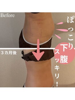 アティレ オオサカ(Attirer Osaka)/痩せたい！ぽっこりお腹集中