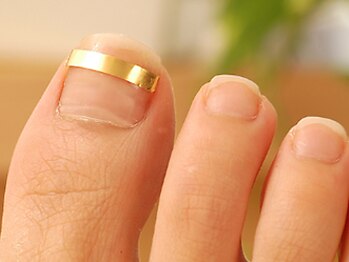 ロワの写真/なかなか改善しなかった巻き爪・足元トラブルでお悩みの方に◎豊富な経験×高技術で根本改善！