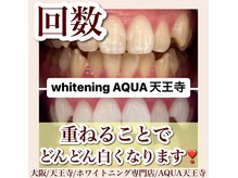 アクア 天王寺店(AQUA)/セルフホワイトニング/天王寺