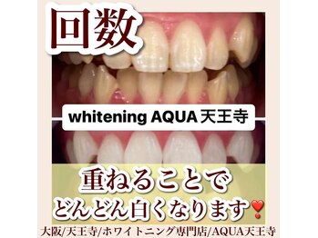 アクア 天王寺店(AQUA)/セルフホワイトニング/天王寺