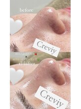 クレヴィー(Creviy)/韓国式3D毛穴洗浄×ハーブ1回