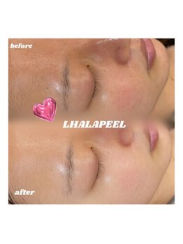 サニーラッシュ &nbsp;高蔵寺 志段味店(Sunny Lash)/大人気ララピール初回￥7,500