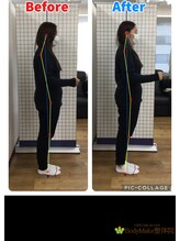 ボディメイク整体院 横浜駅西口店(BodyMake)/施術風景-首が辛い女子大生-